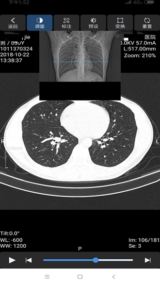 飞图影像 安卓版v2.19.2